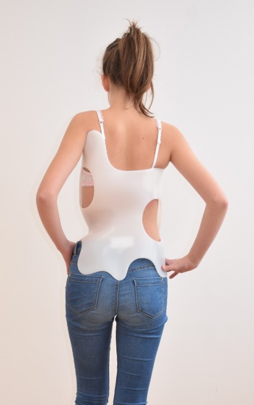 bei idiopathischer Skoliose Fuchs Orthopädietechnik